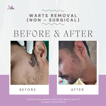 Slider image (7) Konarc Aesthetics - Plastic & Cosmetic Surgery In Gurgaon, India.